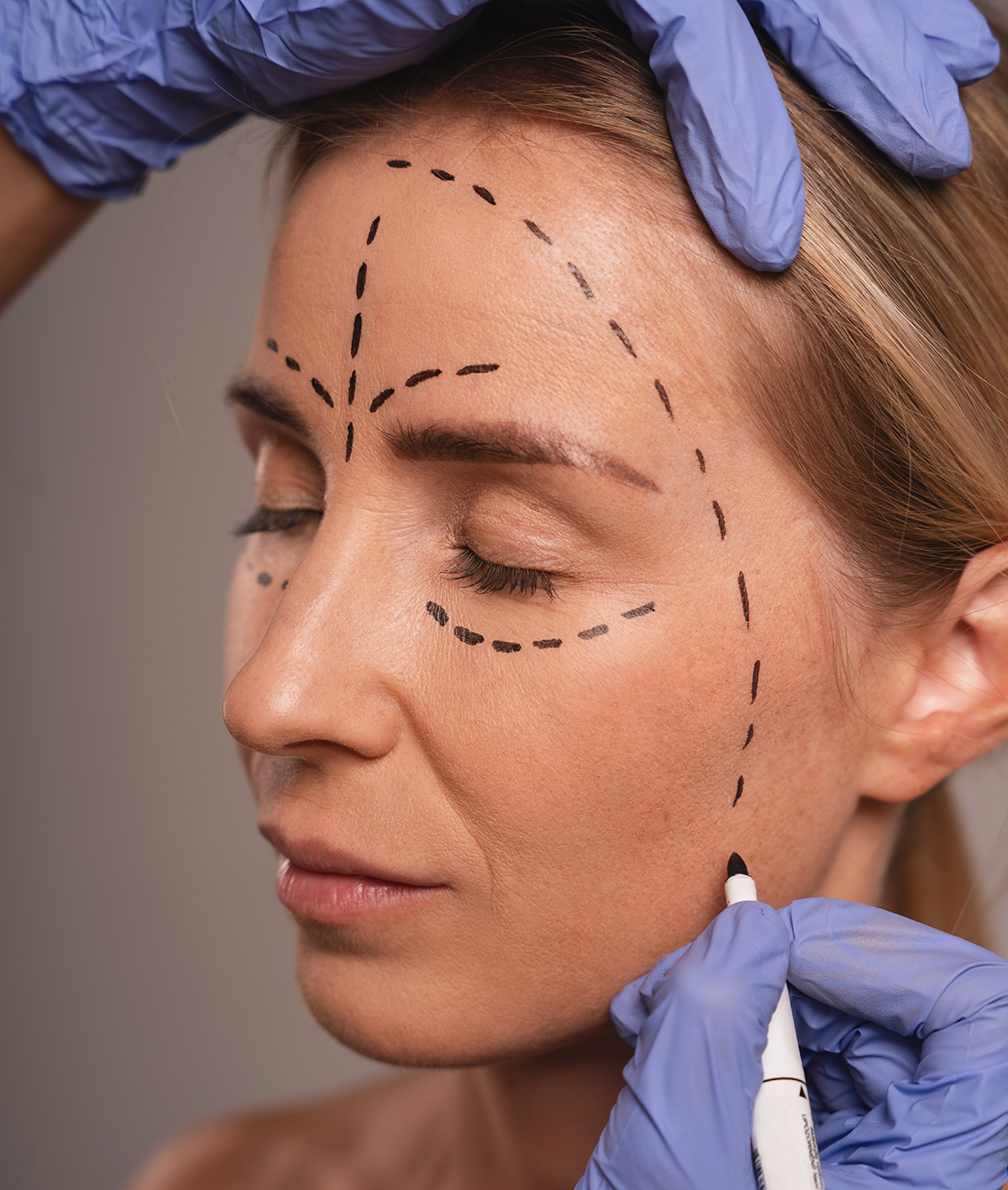 woman-preparing-cosmetic-surgery-(1)