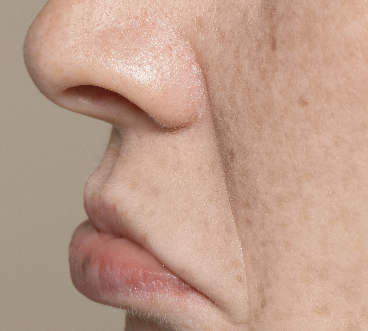 close-up-pores-woman-face